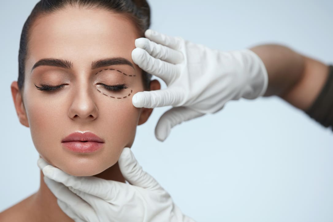 opeluce oculoplastia