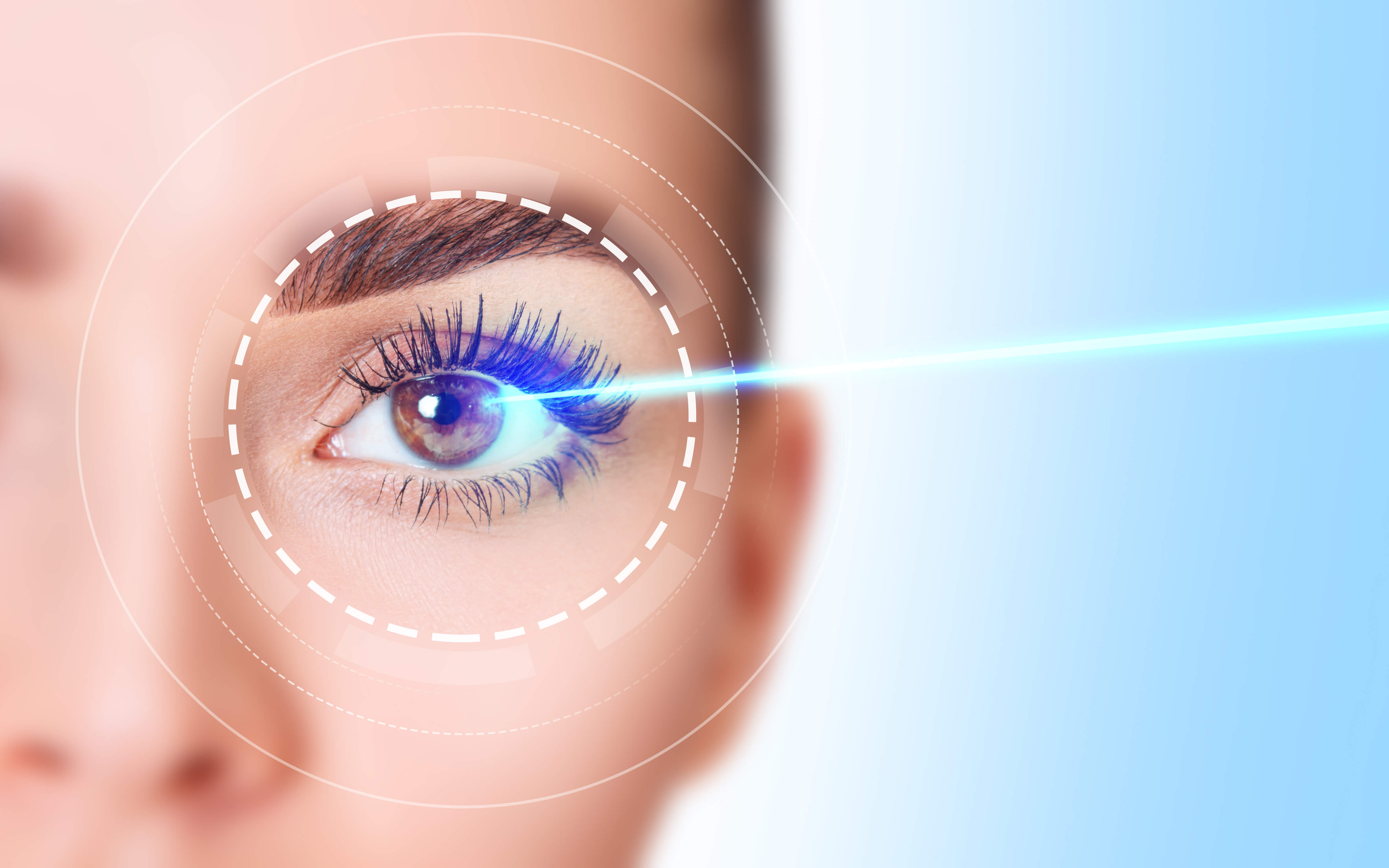yag laser opeluce fotos
